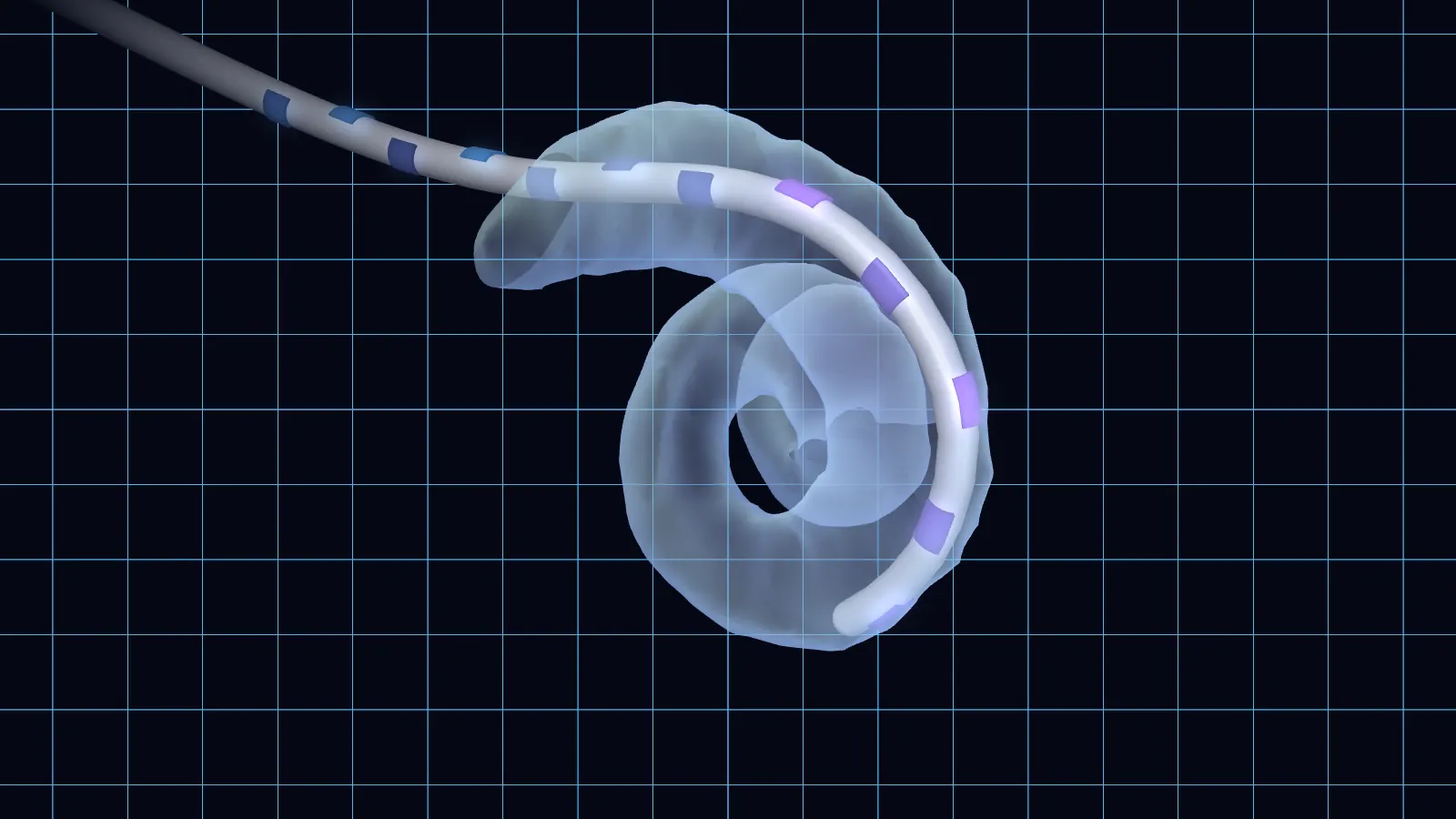 Rendering of a cochlear implant electrode array threading into a translucent cochlea.